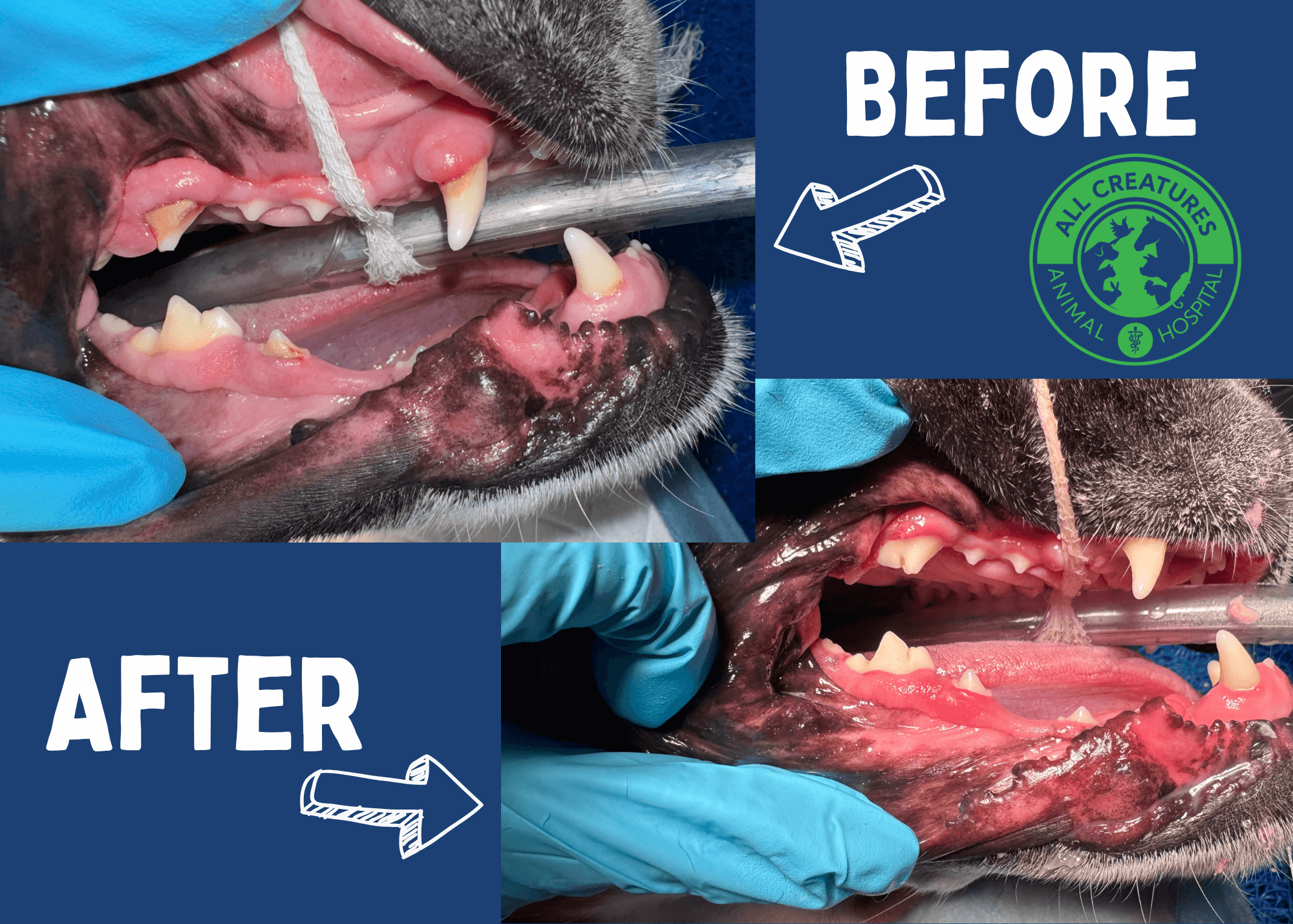 Before and After of Dental Cleaning Procedure